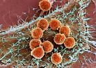 Immunonkológia: új fegyver a daganat elleni harcban