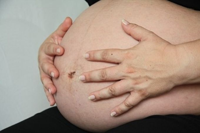 A fogágy gyulladás növelheti a koraszülés kockázatát A fogágy gyulladás növelheti a koraszülés kockázatát