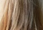 Tizenöt centiméteres hajgombócot operáltak ki egy nő gyomrából