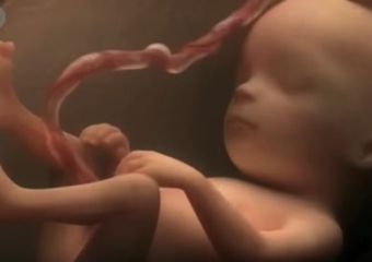 Videó egy pocaklakó mindennapjairól - a megtermékenyüléstől a születésig