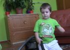 Kézfej nélkül született egy magyar kisfiú, az orvosok 17 ultrahang vizsgálat után sem vették észre a bajt