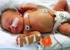 A győri kórházban hagyták kisbabájukat a szülők, mert kiderült, hogy szívbeteg - gyűjtés indult a pici számára