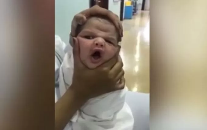 Kirúgták az újszülött arcát nyomorgató szaúdi nővéreket