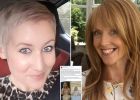 A mellrák felismerése egy kevésbé elterjedt módszerrel - Facebook poszt mentette meg egy nő életét