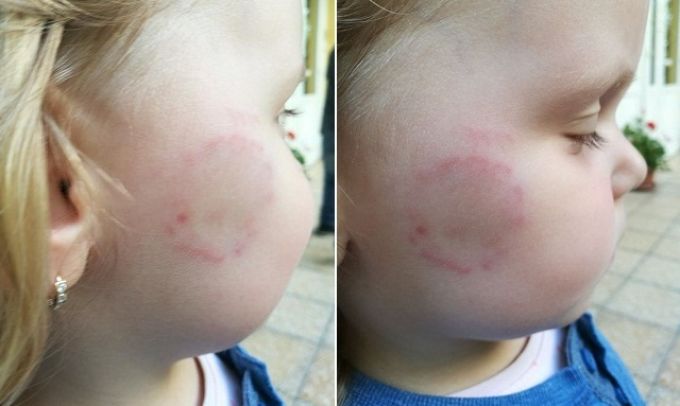 Elképesztő agresszió egy újbudai óvodában - véresre harapják és szexuálisan zaklatják társaikat a gyerekek Elképesztő agresszió egy újbudai óvodában - véresre harapják és szexuálisan zaklatják társaikat a gyerekek