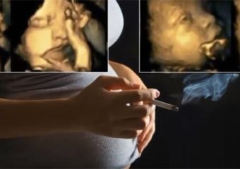 Beszédes ultrahang képek: szó szerint szenved a magzat, ha rágyújt az anya