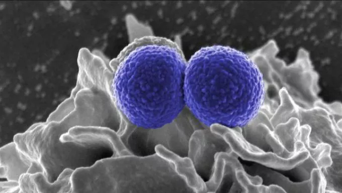 Emberek és baktériumok háborúja - Győzhetünk-e?