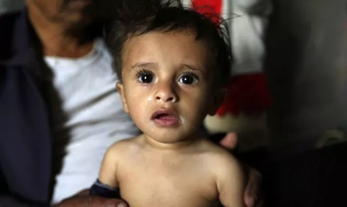 Jemen: kórházban fekvő gyerekek élete forog veszélyben - Te is segíthetsz!