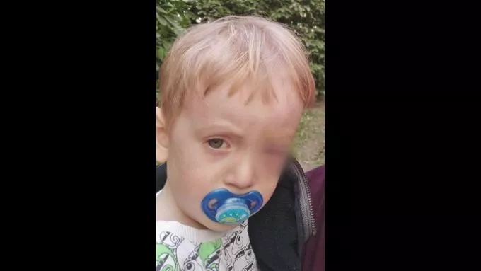 Bot fúródott a szemébe: 21 órát várt a kétéves gyermek, mire ellátták a súlyos szemsérülését - a kórházak egymásra mutogatnak