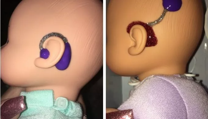 Hallókészülékes babákat készített a csoportjának egy óvónő