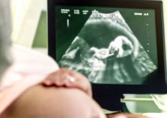 Ezt jelentik a rövidítések az ultrahangeredményen