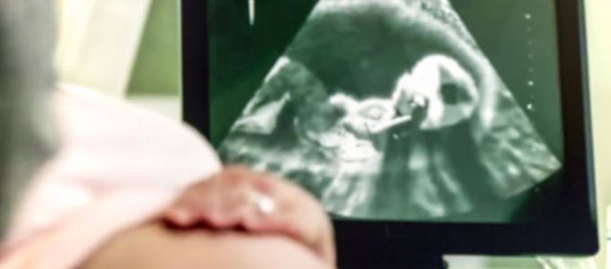 Ezt jelentik a rövidítések az ultrahangeredményen Ezt jelentik a rövidítések az ultrahangeredményen