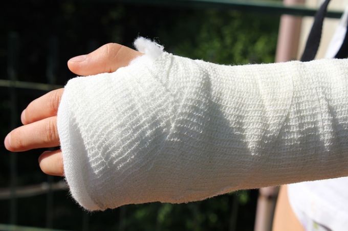 Mi tegyünk és mit NE tegyünk, ha eltörött a gyerek keze? - Teendők csonttörés esetén Mi tegyünk és mit NE tegyünk, ha eltörött a gyerek keze? - Teendők csonttörés esetén