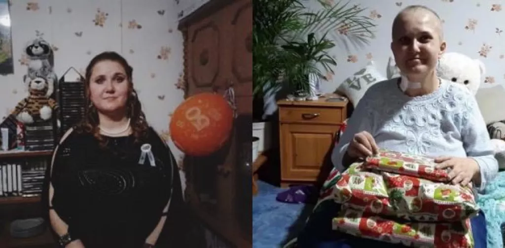 Vanessza kemoterápia előtt és után