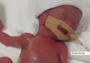 Így néz ki most a világ legkisebb babája, aki egy év után hagyhatta el a kórházat