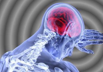 A beteg együttműködése az egyik legfontosabb tényező egy stroke után