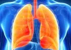 Idiopathiás tüdőfibrózis (IPF) - Szeptember, a ritka tüdőbetegségek hónapja