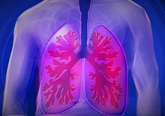 A tüdőrákban elhunytak száma szűrővizsgálatokkal csökkenthető!