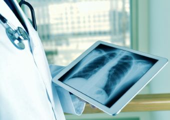 Hordozható röntgen készülékek és színes felvételek mutatják majd unokáink csonttöréseit