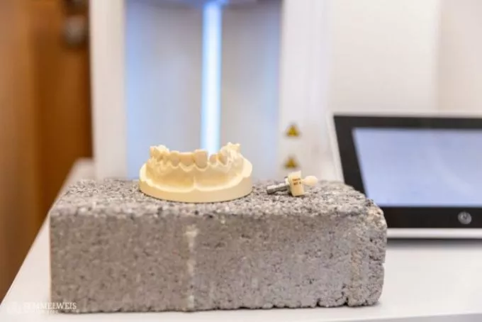 Fogorvosok és mérnökök szaktudását ötvözik a digitális fogászati tervezők