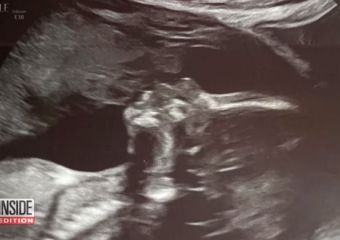 Babáját csókoló angyalt vett észre az ultrahang képen - a kismama szerint elhunyt édesapja van a fotón