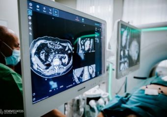 Új navigációs rendszer segíti az onkológiai betegek ellátását a Semmelweis Egyetemen