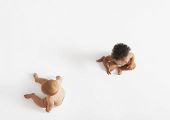 Különböző bőrszínű ikreket szült a fehér anya - nem akarják elhinni, hogy mindkét baba az ő gyereke