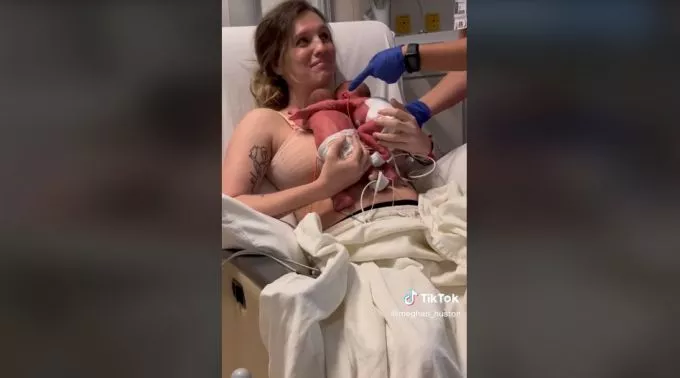 Átkarolták egymást - megható videó a koraszülött ikerbabák első találkozásáról Átkarolták egymást - megható videó a koraszülött ikerbabák első találkozásáról