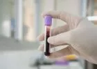 Miért fontos érteni a teljes vérkép laborparamétereit?
