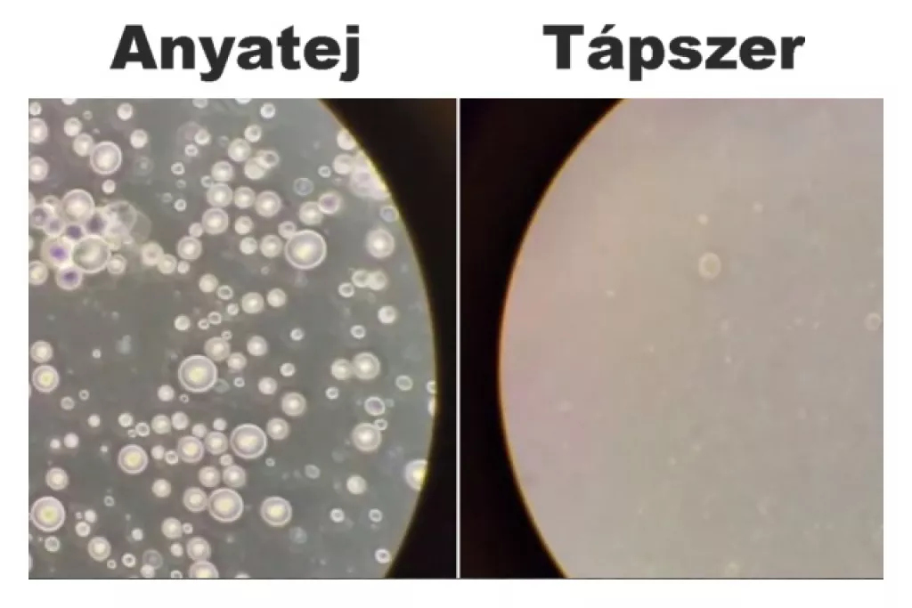 Az anyatej: élő, gyógyító csoda