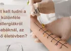 Allergia és ekcéma csecsemőkorban - öröklődés, tünetek, megelőzés - VIDEÓVAL