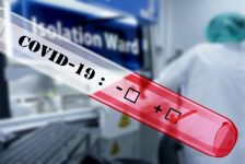 Jelent-e a COVID-19 vírussal szemben fokozott fogékonyságot a csökkent pajzsmirigyműködés?